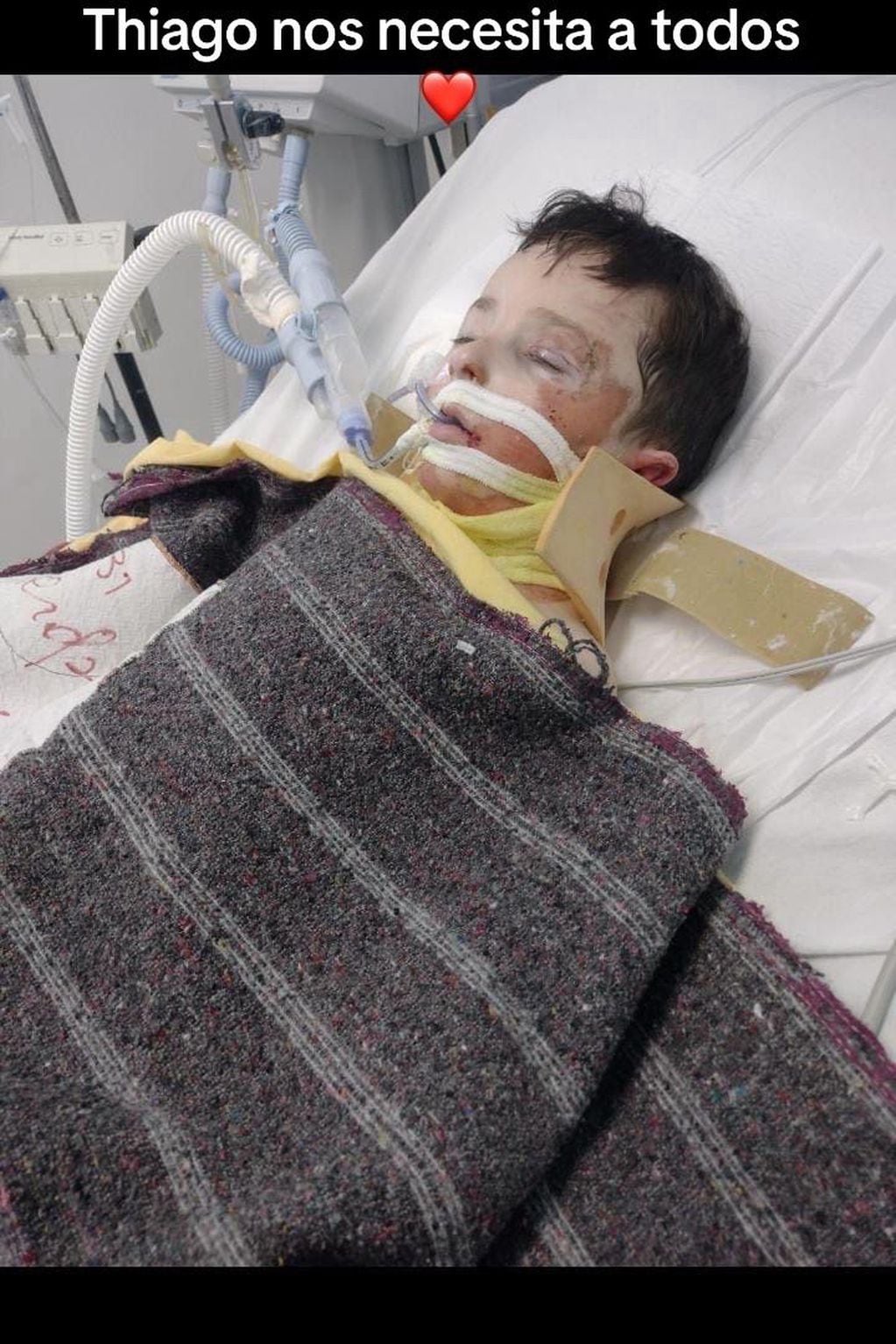 Thiago quedó cuadripléjico por un conductor que corría picadas y necesita ayuda para un costoso tratamiento. Foto: Gentileza Robando Sonrisas