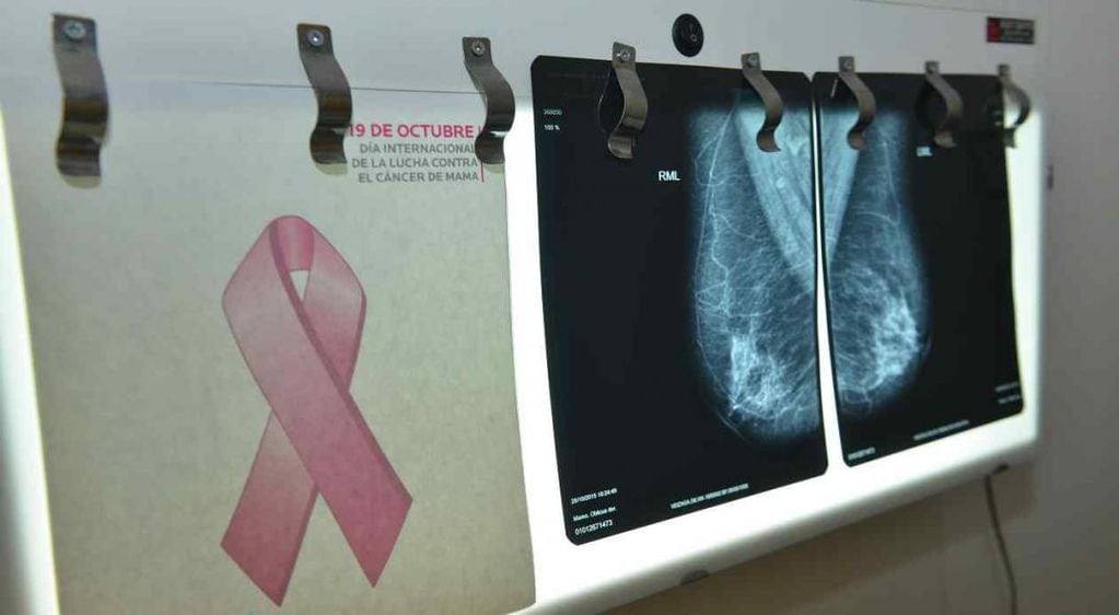  El 19 de octubre es el Día Internacional de Lucha contra el cáncer de mama