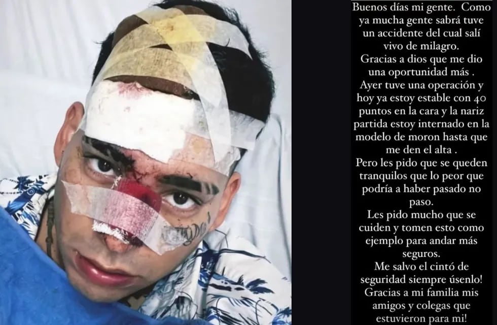 El cantante Kaleb Di Masi chocó contra un patrullero en Buenos Aires y tuvo que ser hospitalizado: “Estoy vivo de milagro”