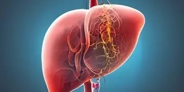 La enfermedad grasa del hígado, actualmente denominada esteatosis hepática es una epidemia oculta