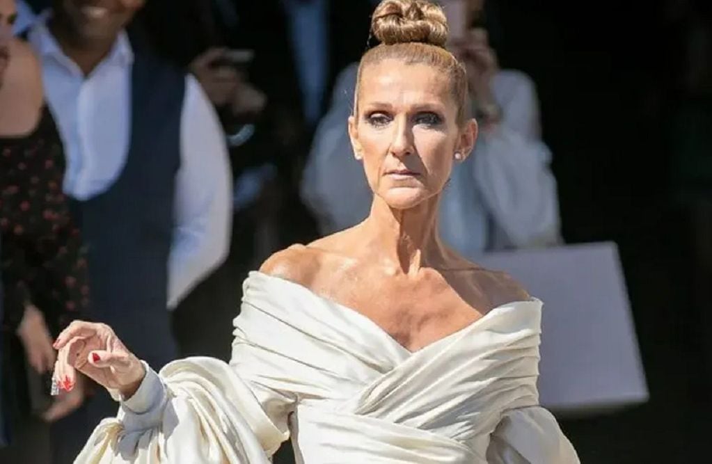 La cantante Céline Dion padece el síndrome de la persona rígida