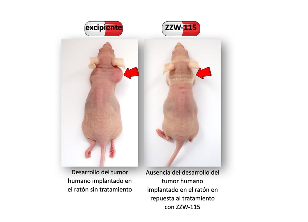 Prueba sobre desarrollo del tumor humano implantado en el ratón sin tratamiento y luego ausencia del desarrollo del tumor humano implantado en el ratón en repuesta al tratamiento con ZZW-115