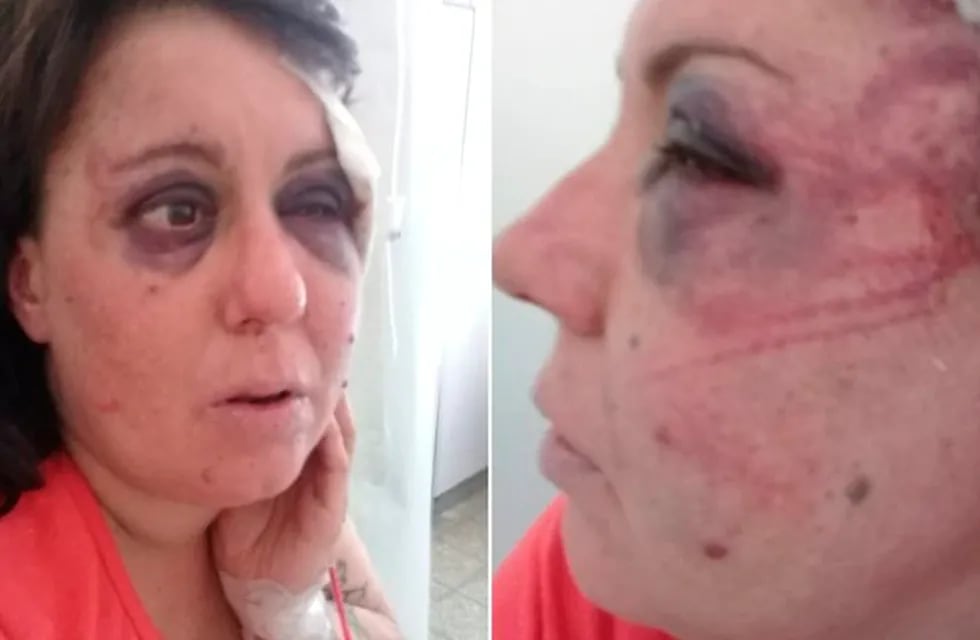 Gisela Knorr fue brutalmente golpeada por el comisario en 2019.