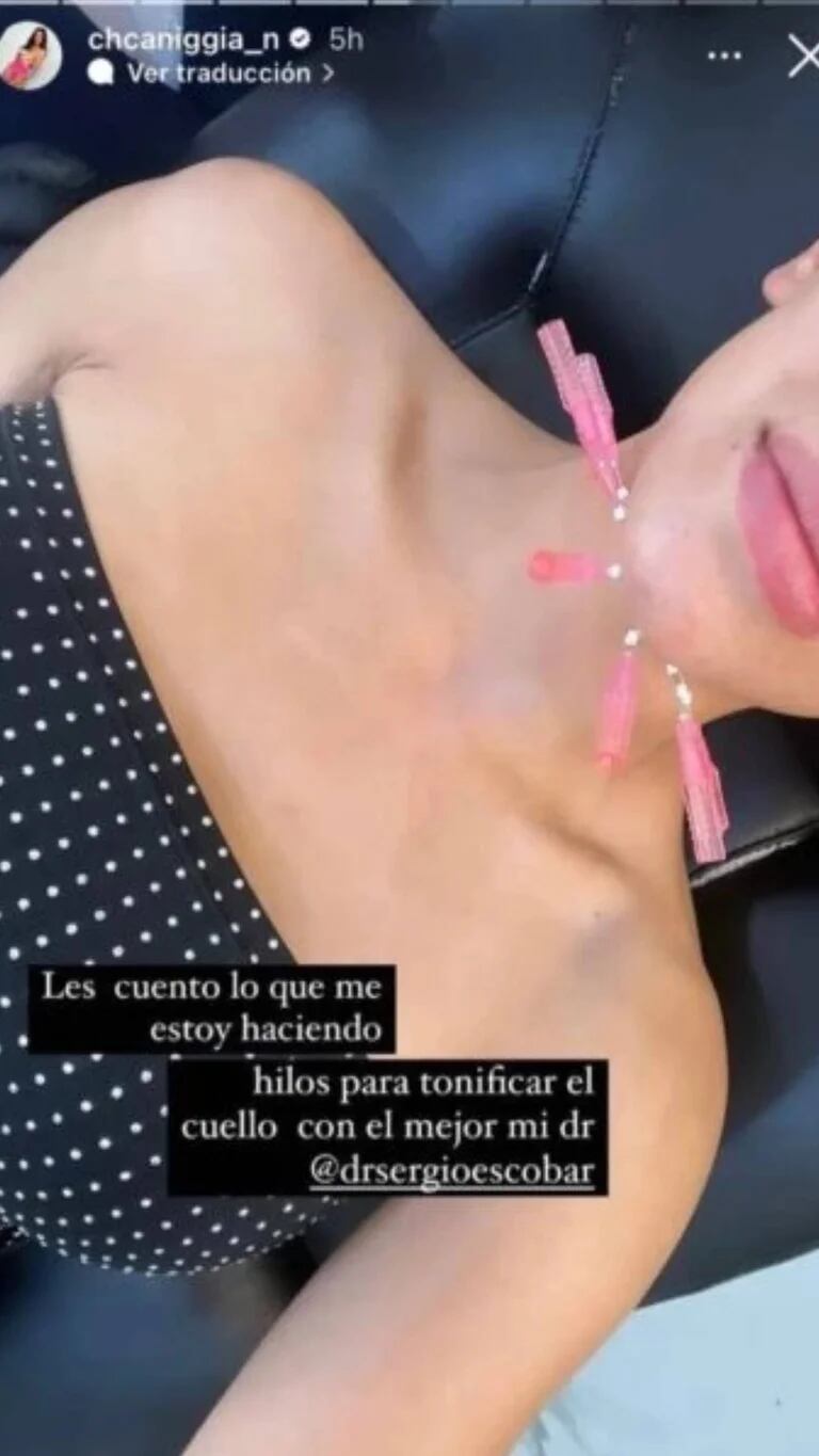 Este es el rotoque estético que se hizo Charlotte Caniggia.