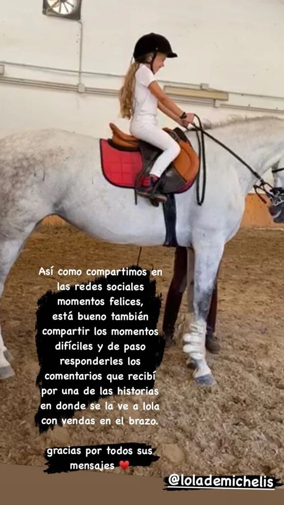 Lola fue golpeada por su caballo cuando el animal se puso a pelear con otro.