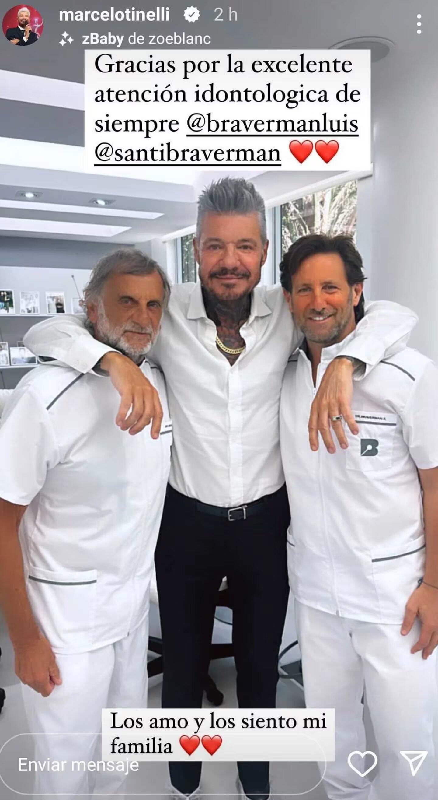 Marcelo Tinelli se hizo una intervención previo a la final del Bailando 2023.