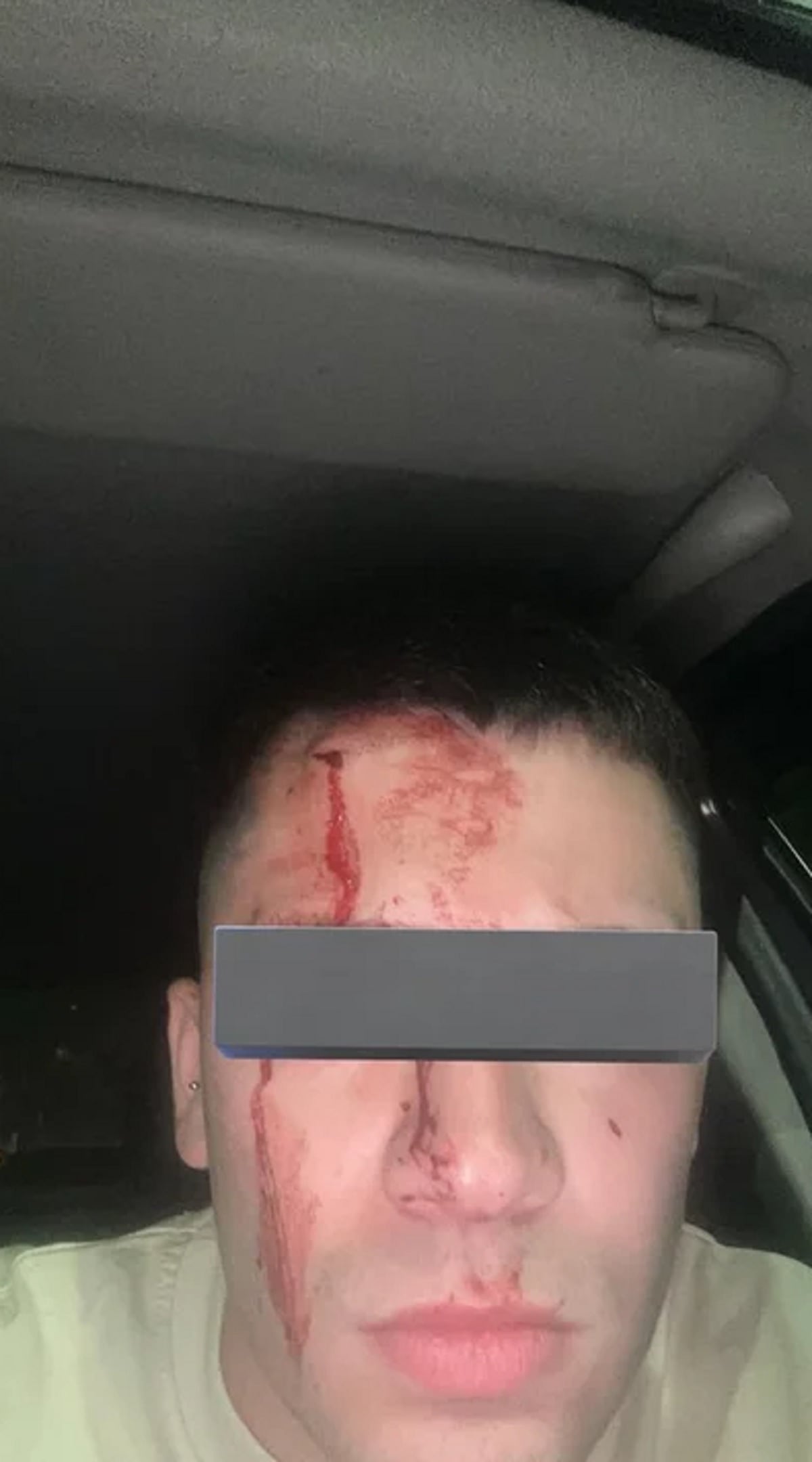 Así quedó el socio del rojo agredido por Marcone (Foto: NA)