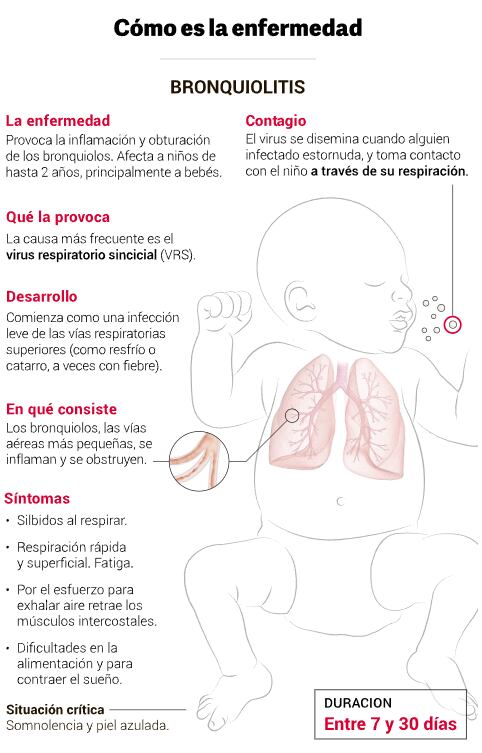 Bronquiolitis: cómo es la enfermedad. Foto: Clarín