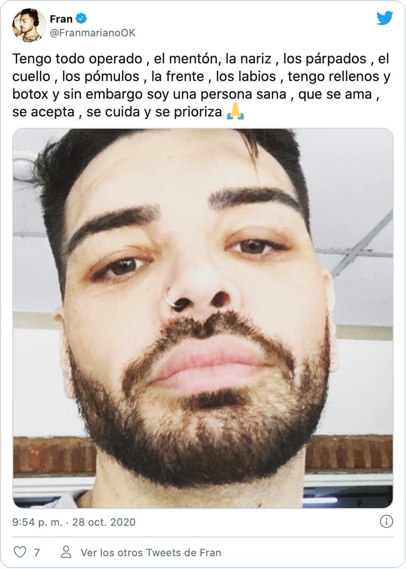 El posteo donde sus seguidores vieron su nueva cara.