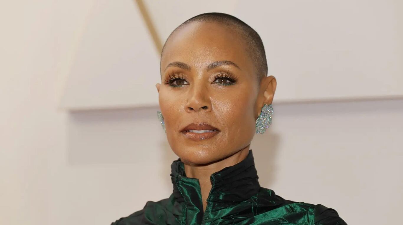 Jada Pinkett, la esposa de Will Smith, padece alopecia. 