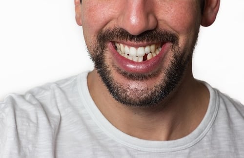 Qué significa soñar con la caída de los dientes.