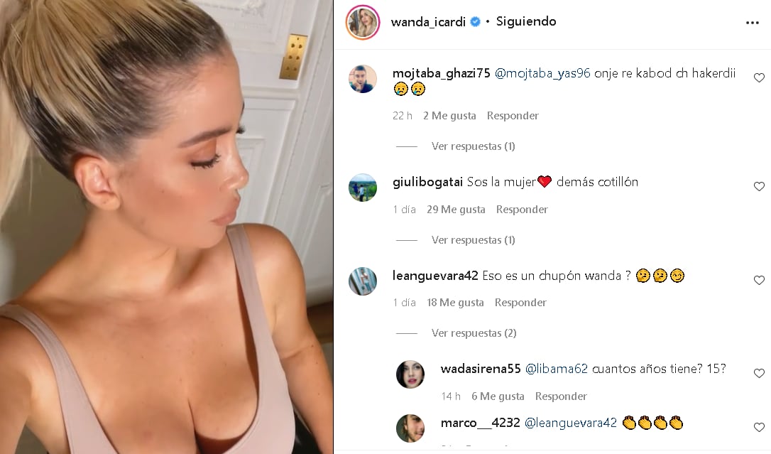 Los seguidores de Wanda aseguran que la blonda tiene un chupón a la vista.