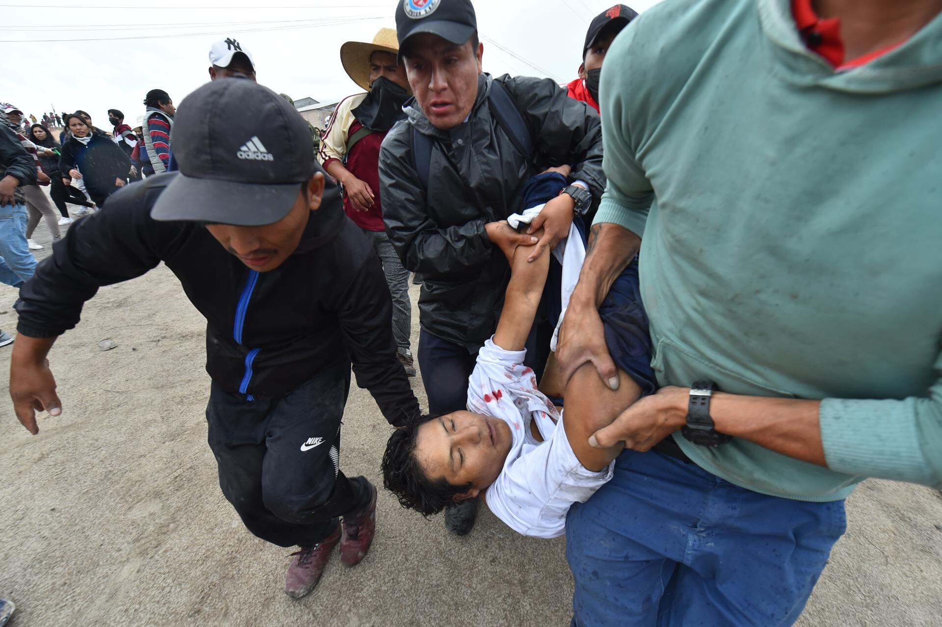 Un grupo de manifestantes trasladan a un herido de gravedad durante una marcha contra el Gobierno de la presidenta Dina Boluarte hoy, en Arequipa (Perú). La gran marcha nacional denominada "la toma de Lima", que pide la renuncia de la presidenta Dina Boluarte, ha activado una serie de acciones de protesta en distintos puntos del país. Hasta el momento, las protestas han dejado 43 manifestantes y un policía muertos. Foto: EFE/ Jose Sotomayor Jiménez