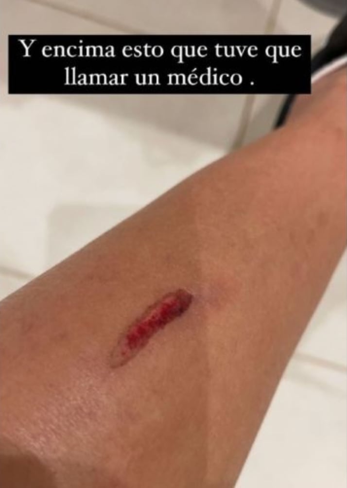 Cinthia golpeó un poste de la bronca.