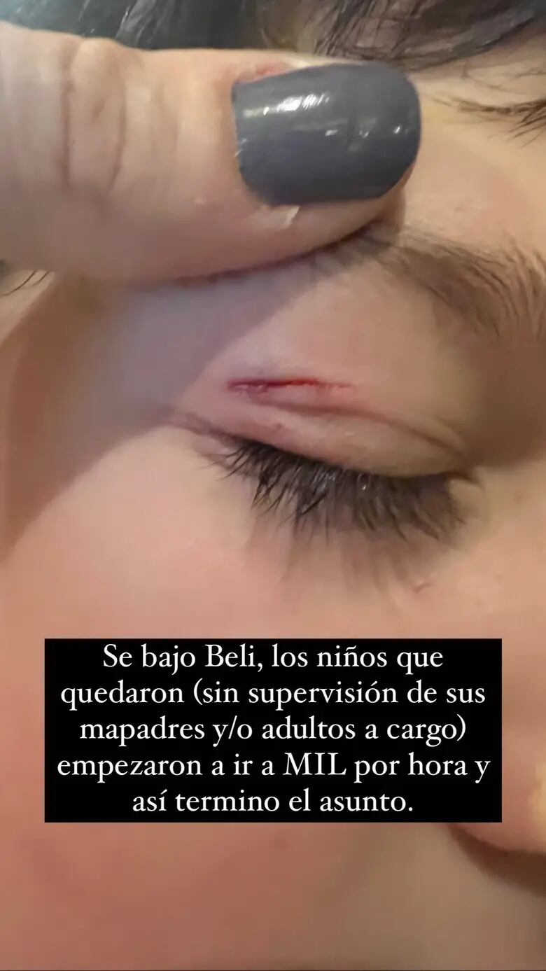 Juana Repetto contra las calesitas después de que su hijo se accidentara