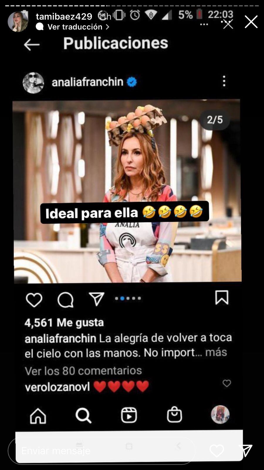 Analía Franchín criticó los retoques de Tamara Báez.