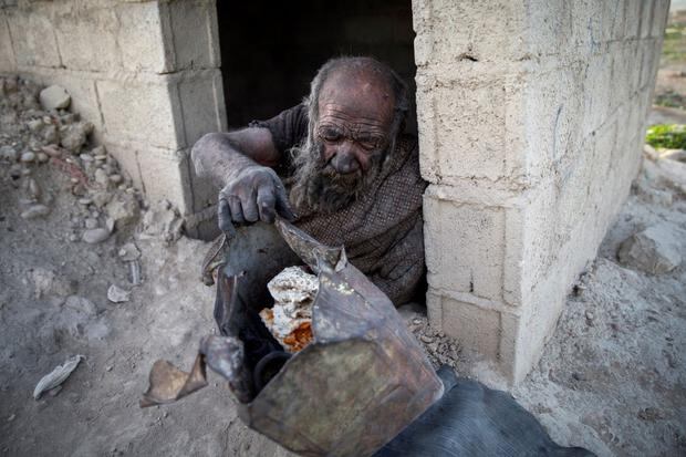 Un iraní vivió hasta los 94 años y pasó más de 6 décadas sin higienizarse.