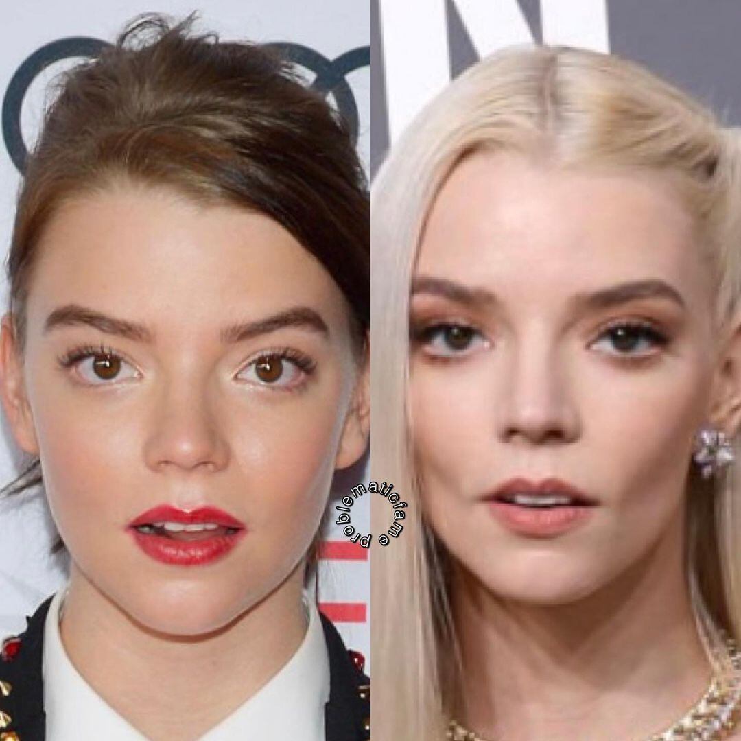 El antes y después de Anya Taylor-Joy