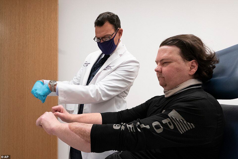 Joe DiMeo, un sujeto residente de Nueva Jersey, que sufrió quemaduras en el 80% de su cuerpo en julio de 2018. Foto: Gentileza