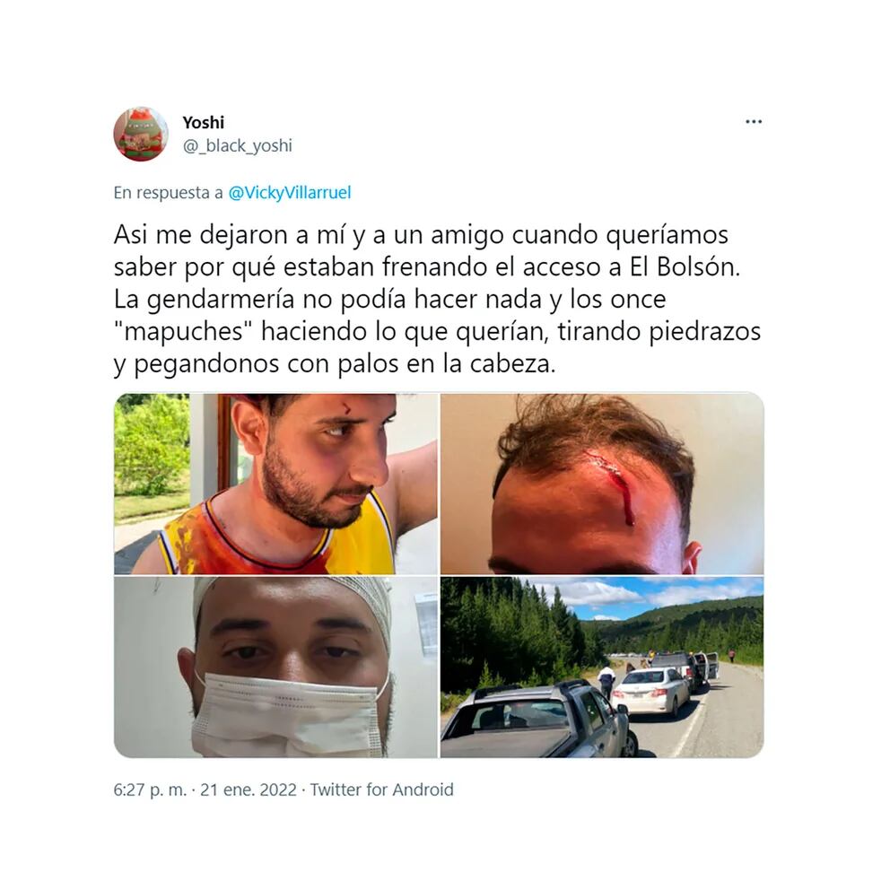 Los jóvenes heridos denunciaron la agresión en las redes sociales.