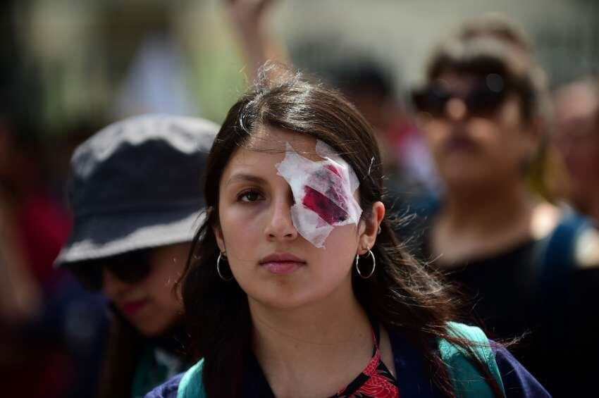 
En chile. Hay cientos de heridos tras las protestas. | AFP
   