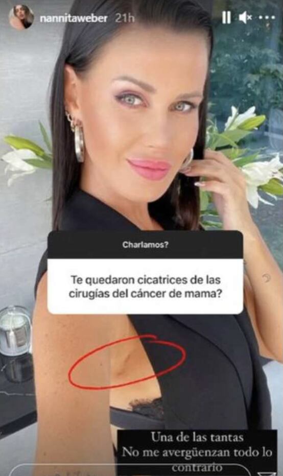 Natalie Weber y las fotos donde muestra con orgullo la cicatriz de su mastectomía