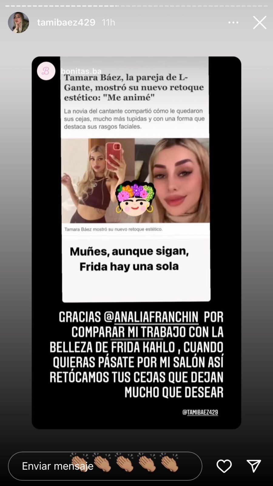 Analía Franchín criticó los retoques de Tamara Báez.