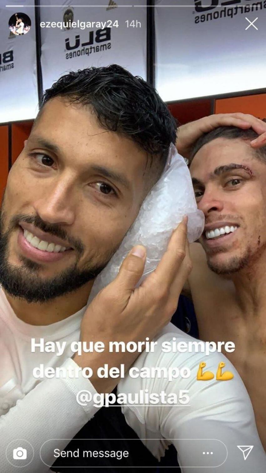 
    Garay, a pesar del dolor, se mostró con una sonrisa.
   