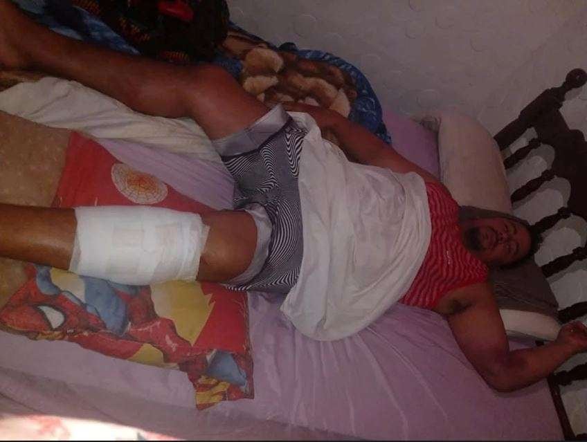 
Hernan tras ser operado por la herida sufrida en el parque. | Gentileza
   