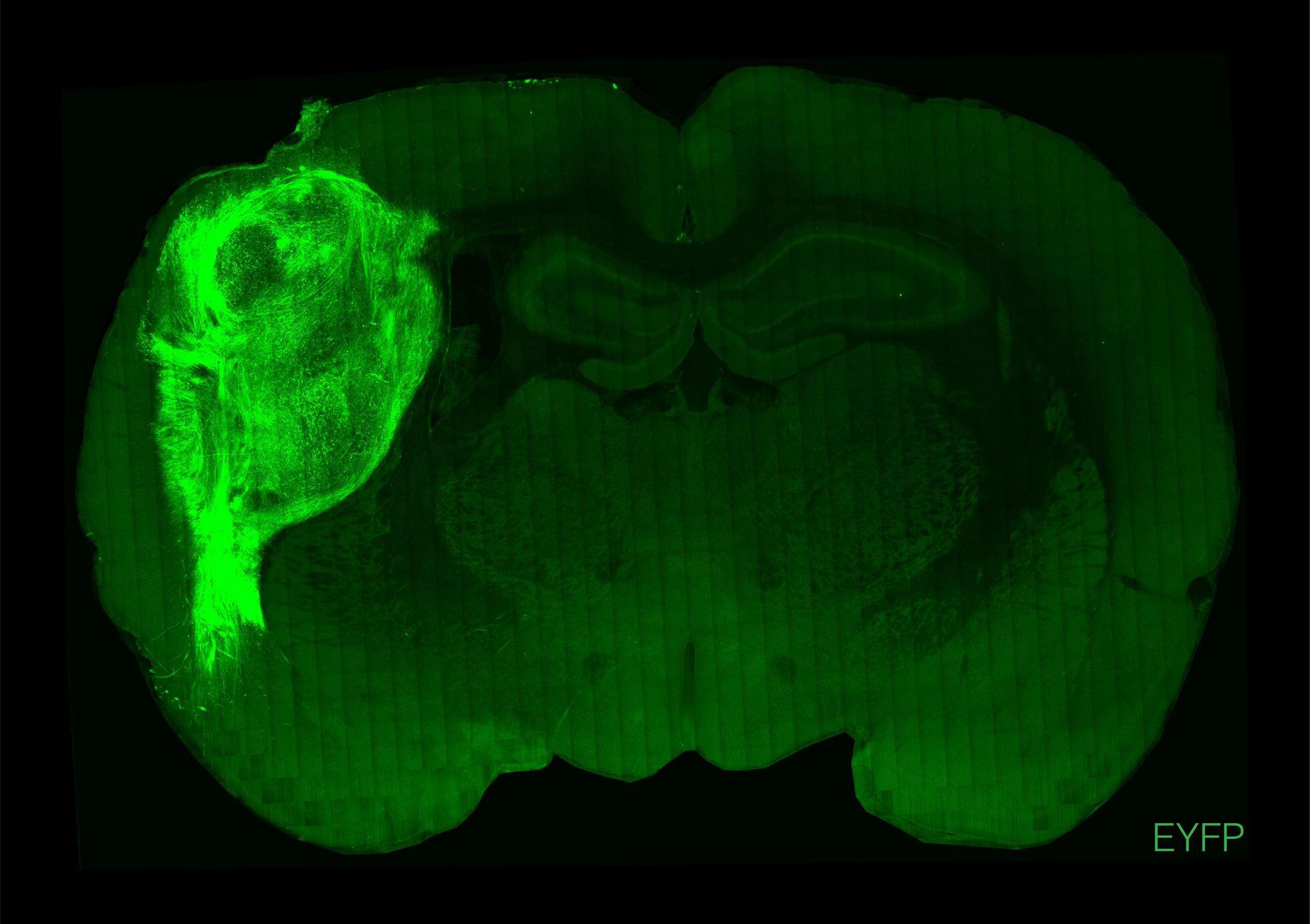 Un organoide cerebral humano, marcado con una proteína fluorescente y trasplantado al cerebro de una rata - Universidad Stanford