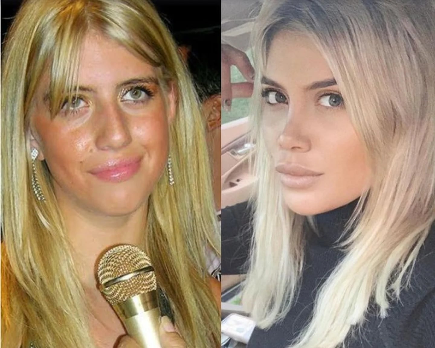 El antes y despues de Wanda Nara.