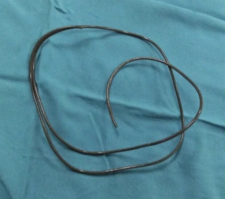 El hombre se había metido un cable de auricular para sentir más placer al masturbarse.