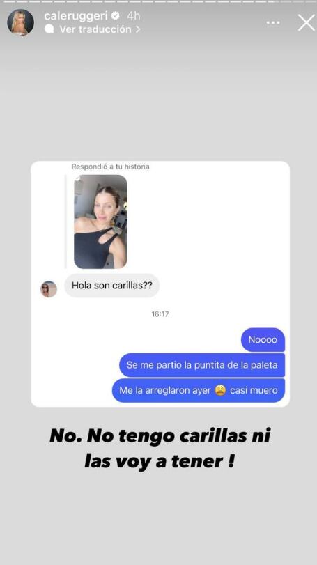 Se le rompió un diente a la modelo y aprovechó para reirse (luego de llorar).