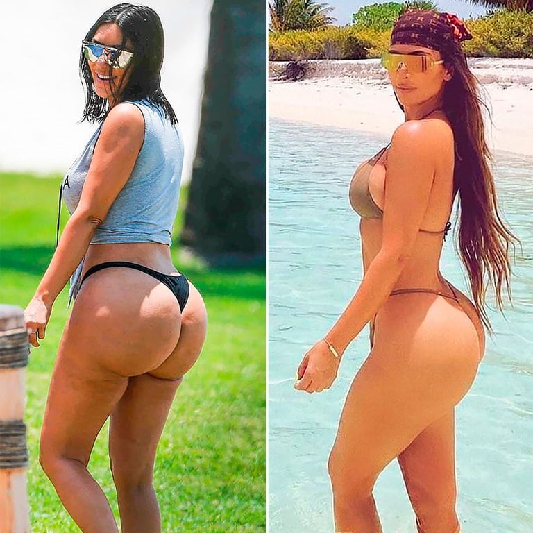 Kim Kardashian y una larga historia de retoques.