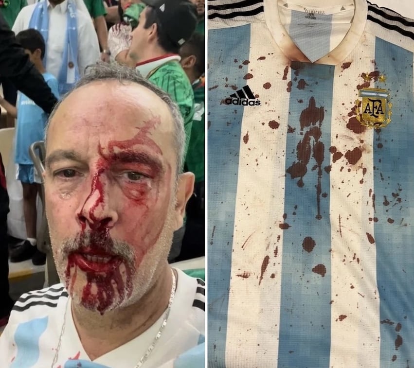 El hincha argentino Luis Aguirre contó la agresión sufrida en Qatar en pleno partido por fanáticos de México.