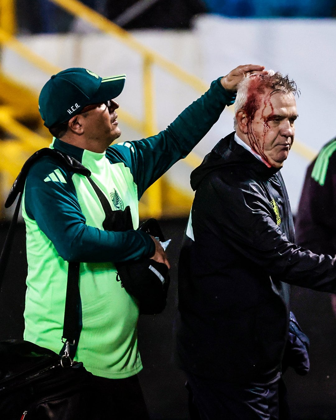 Así quedó Javier Aguirre, DT de la Selección de México, tras ser agredido por un hincha hondureño.