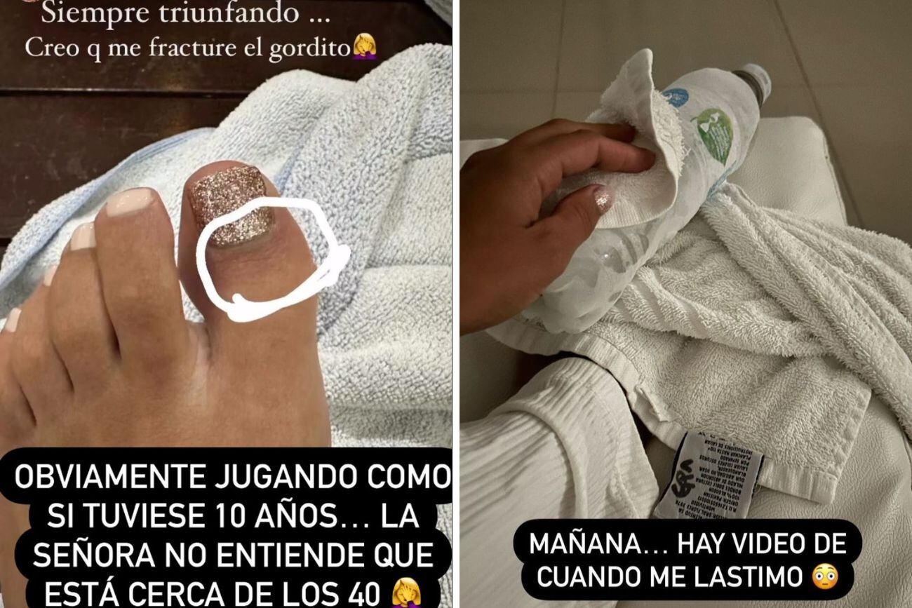 Cinthia Fernández sufrió un accidente durante sus vacaciones.