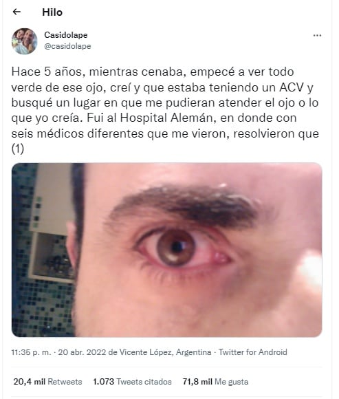 Un joven contó por Twitter que se salvó de quedarse ciego gracias a reconocer los síntomas de desprendimiento de retina.