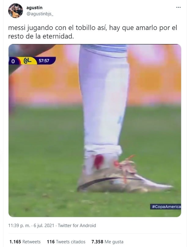 Messi y su tobillo ensangrentado