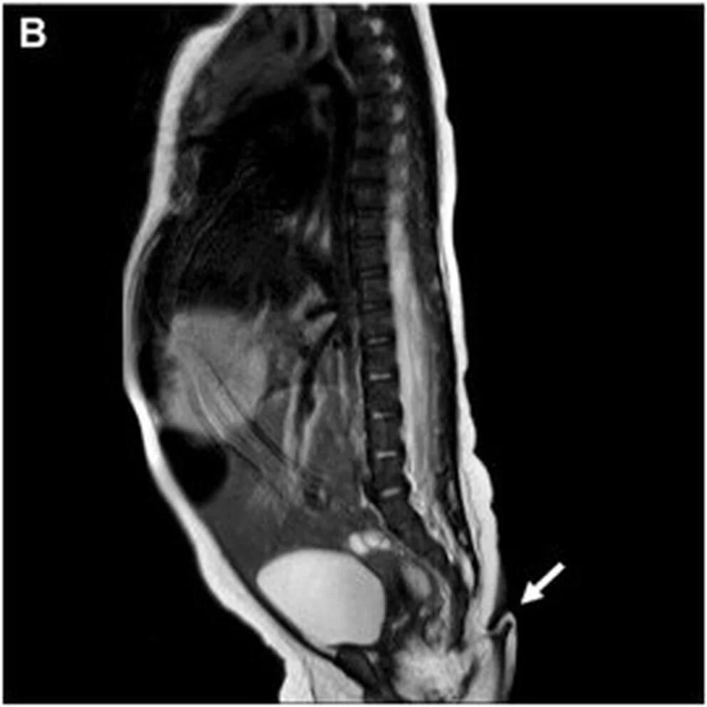 La radiografía en la que se puede observar la protuberancia de la paciente.