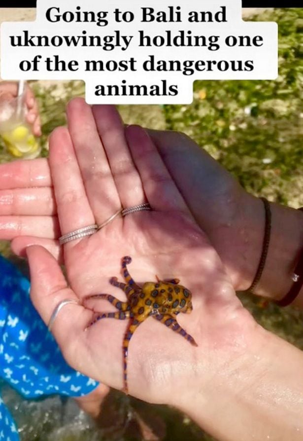 Una chica tomó con sus manos un pequeño pulpo, pero no sabía que era venenoso.