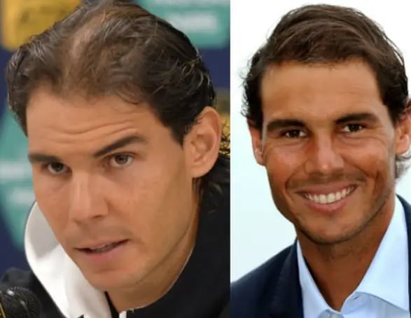 Rafa Nadal