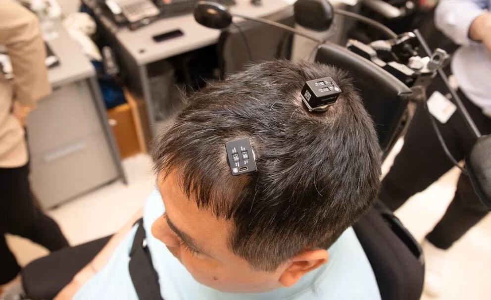 Thomas se convirtió en el primer ser humano en utilizar un implante de microchips en el cerebro, que fue desarrollado por inteligencia artificial (IA). Foto: The Feinstein Institutes for Medical Research/Northwell Health.