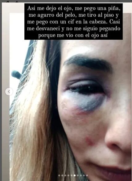 A través de Instagram ella mostró su dolor. 