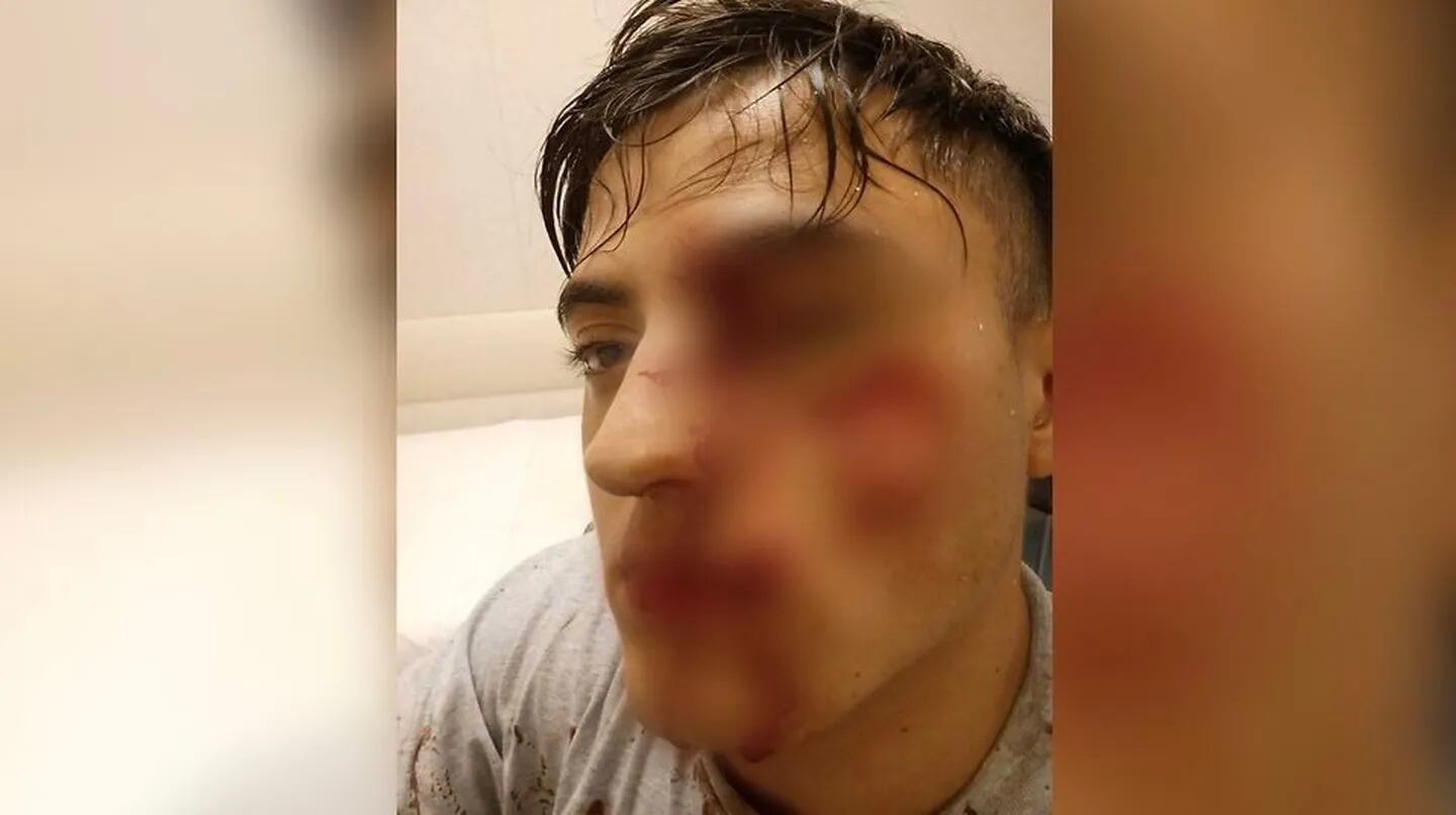 Nicolás García sufrió varios cortes en la cara y perdió la visión de su ojo izquierdo. (Foto: Gentileza)