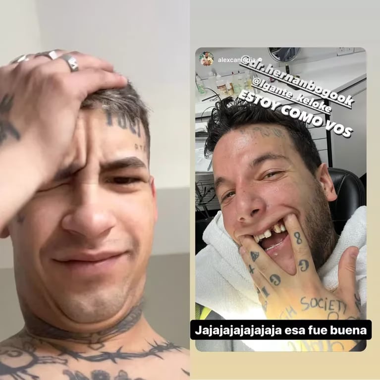 Alex Caniggia comparó su dentadura con la de L-Gante.