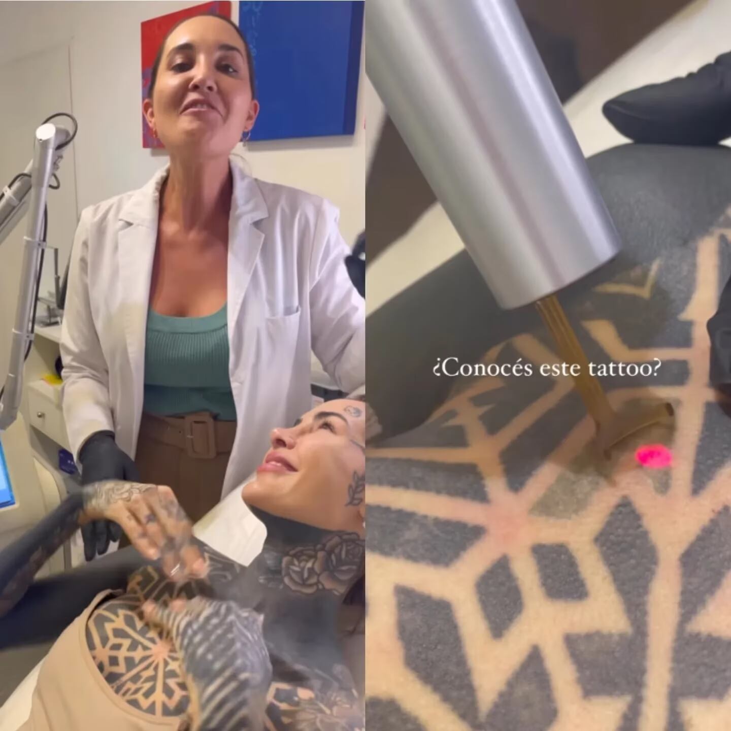 La influencer se borró uno de sus tatuajes.