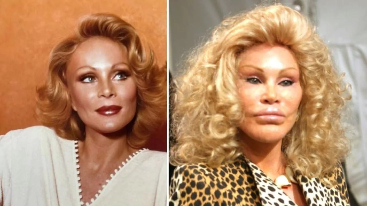 Jocelyn Wildenstein en parte se hizo famosa por su apariencia. 