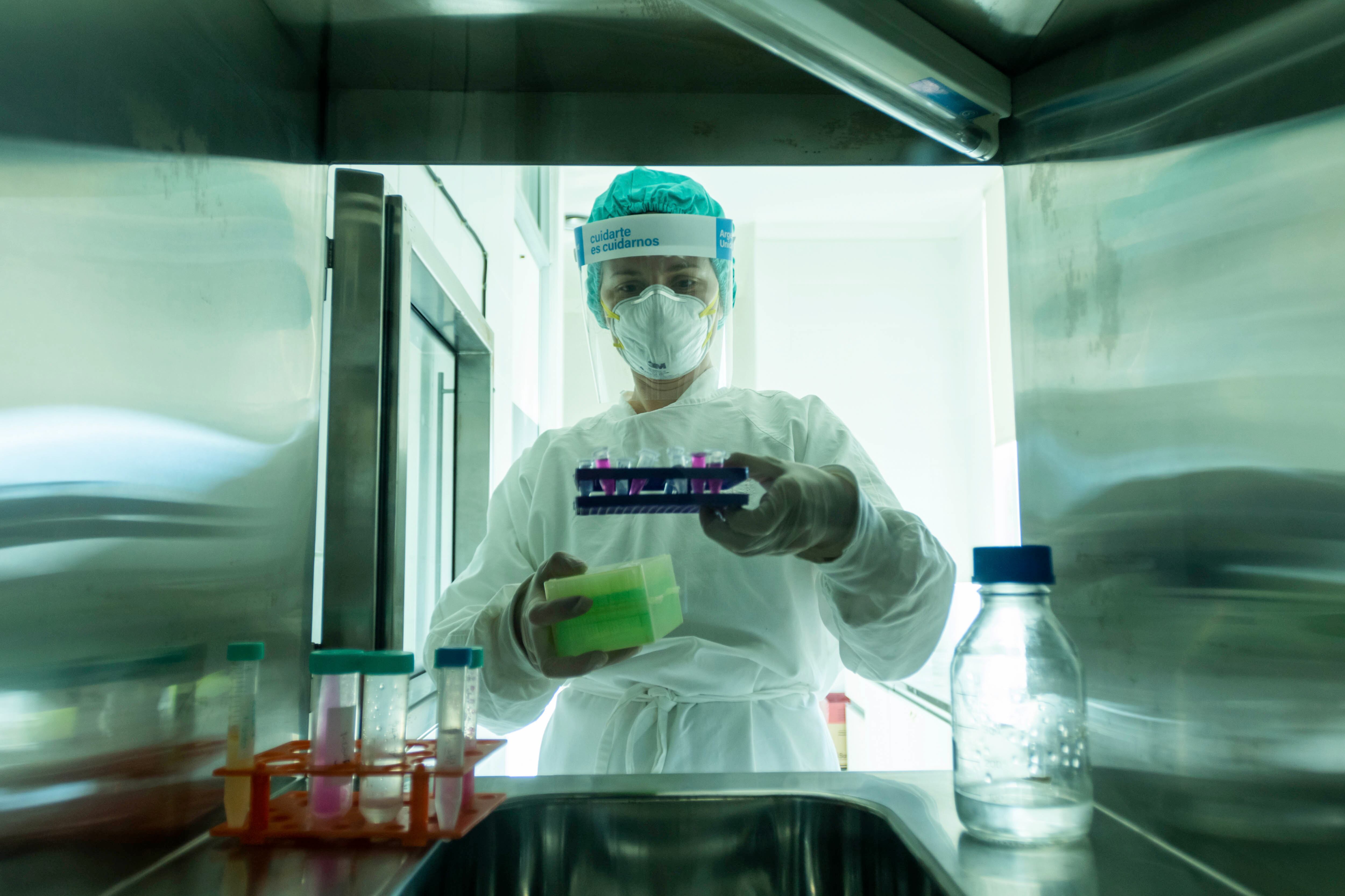 Procedimientos para la extracción de Plasma de pacientes que tuvieron Covid-19