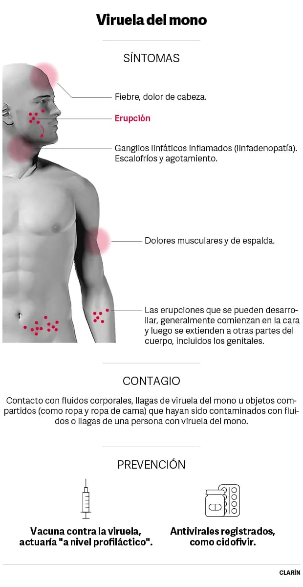 Síntomas de la viruela del mono